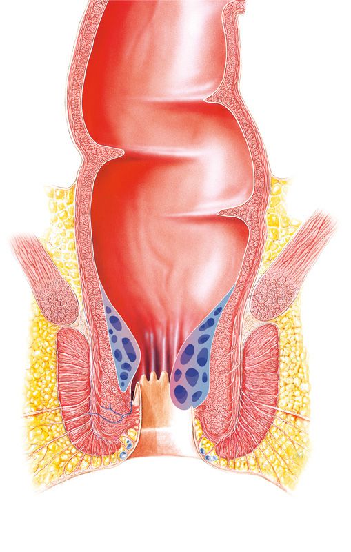 haemorrhoiden 2